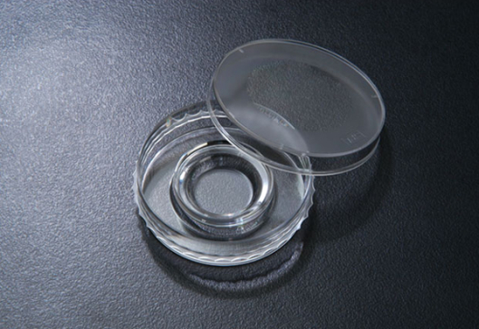لقاح آزمایشگاهی (In vitro Fertilization)